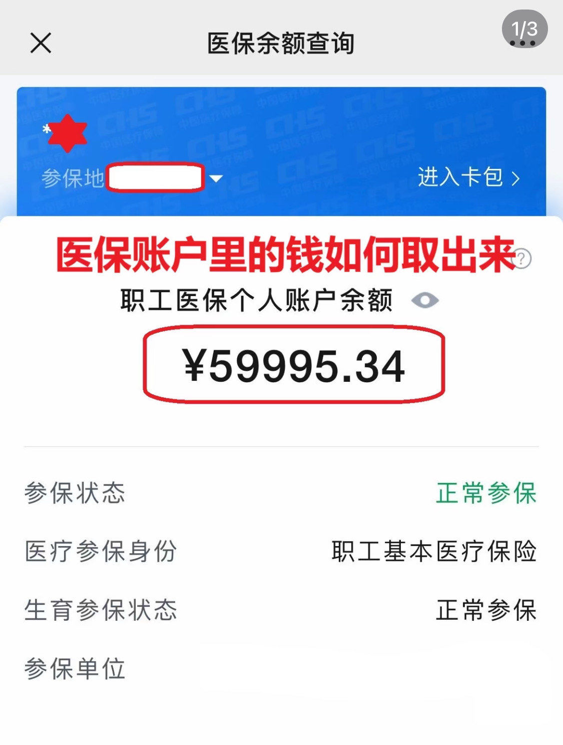 江门为什么医保卡里没有钱(为什么医保卡里没有钱还可以报销)