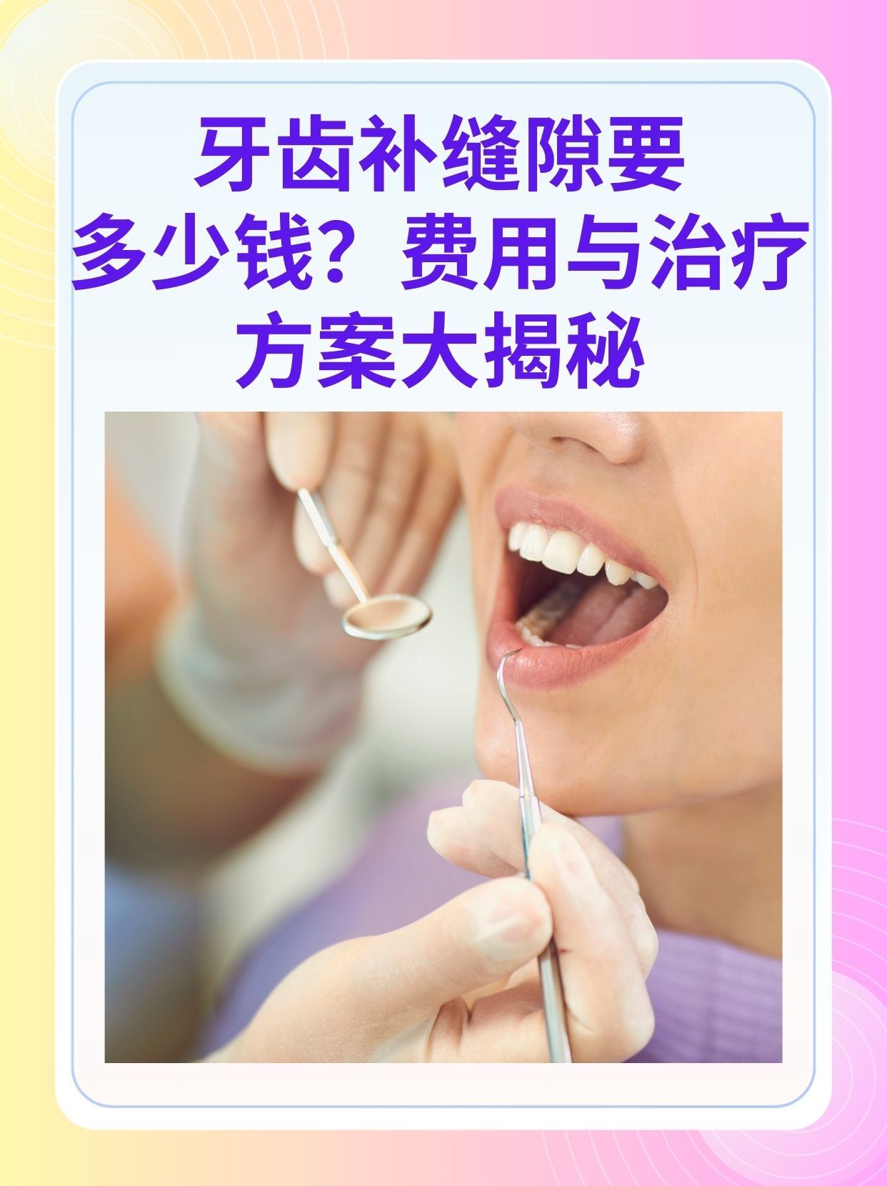 江门补牙医保可以报销吗(补牙医保可以报销吗 哪些可以报销呢)